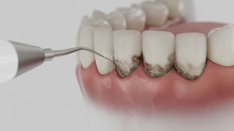 Reliable Dental Implants contractor in Beaufort County County, NC by Dentist Open Now